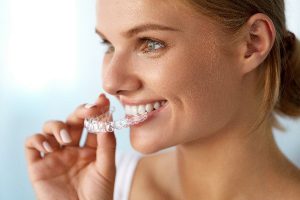 Invisalign Scripps Ranch