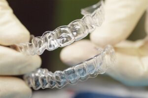 Invisalign in Rancho Peñasquitos