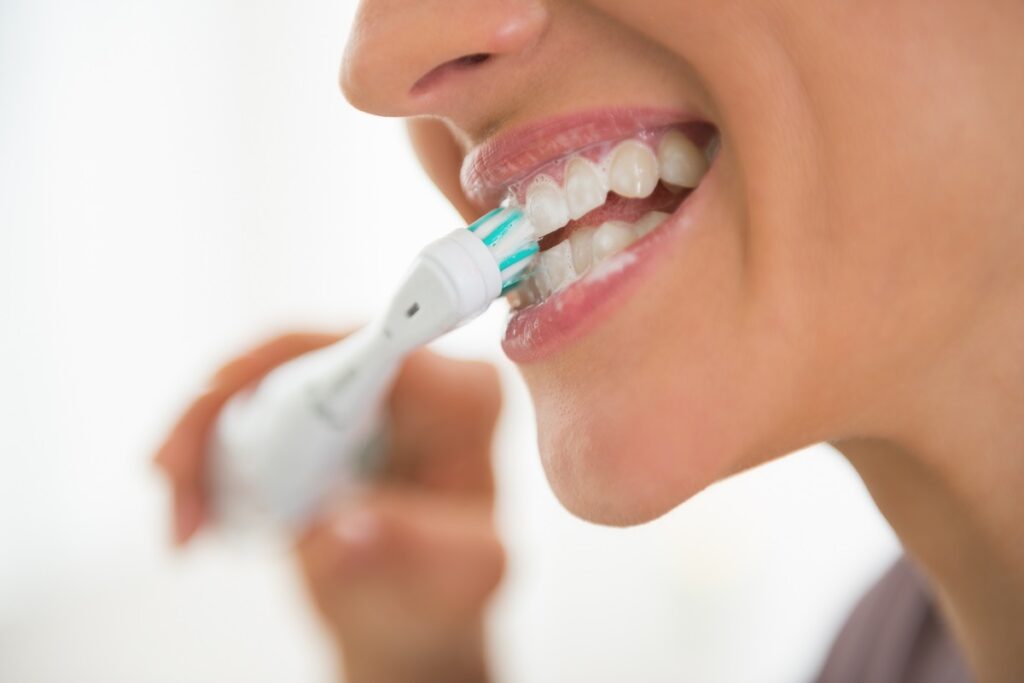 Dental Exams in San Diego