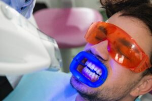 Teeth Whitening in Rancho Peñasquitos